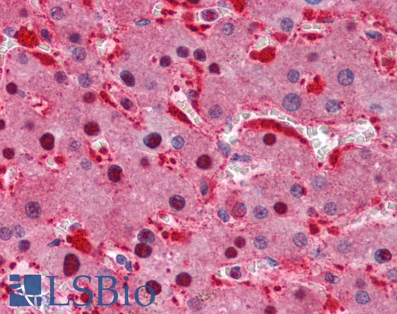 PathPlus™ IDH1 / IDH Antibody