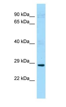 PDCL2 Antibody (aa74-123)