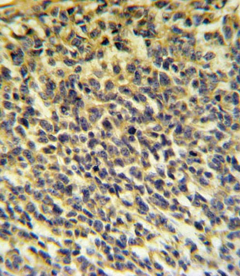 Polyclonal Rabbit anti-Human PLA2G6 / IPLA2 Antibody (aa551-580, IHC, IF, WB)