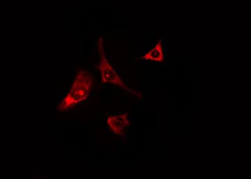 WIPF1 / WIP Antibody