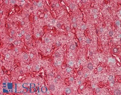 Polyclonal Rabbit anti-Human ANXA4 / Annexin IV Antibody (aa163-258, IHC, WB)