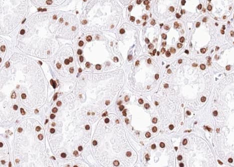 SMC1A / SMC1 Antibody (phospho-Ser957)