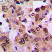 NFKBIB / IKB Beta / IKBB Antibody (phospho-Ser23)