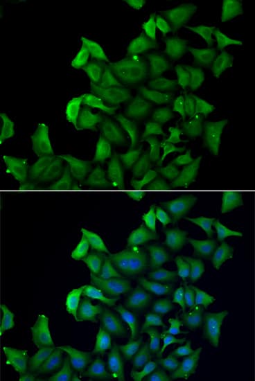 Polyclonal Rabbit anti-Human E-FABP / FABP5 Antibody (IF, WB)