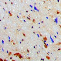 Polyclonal Rabbit anti-Human NARG1 / NAA15 Antibody (Internal, IHC, IF, WB)