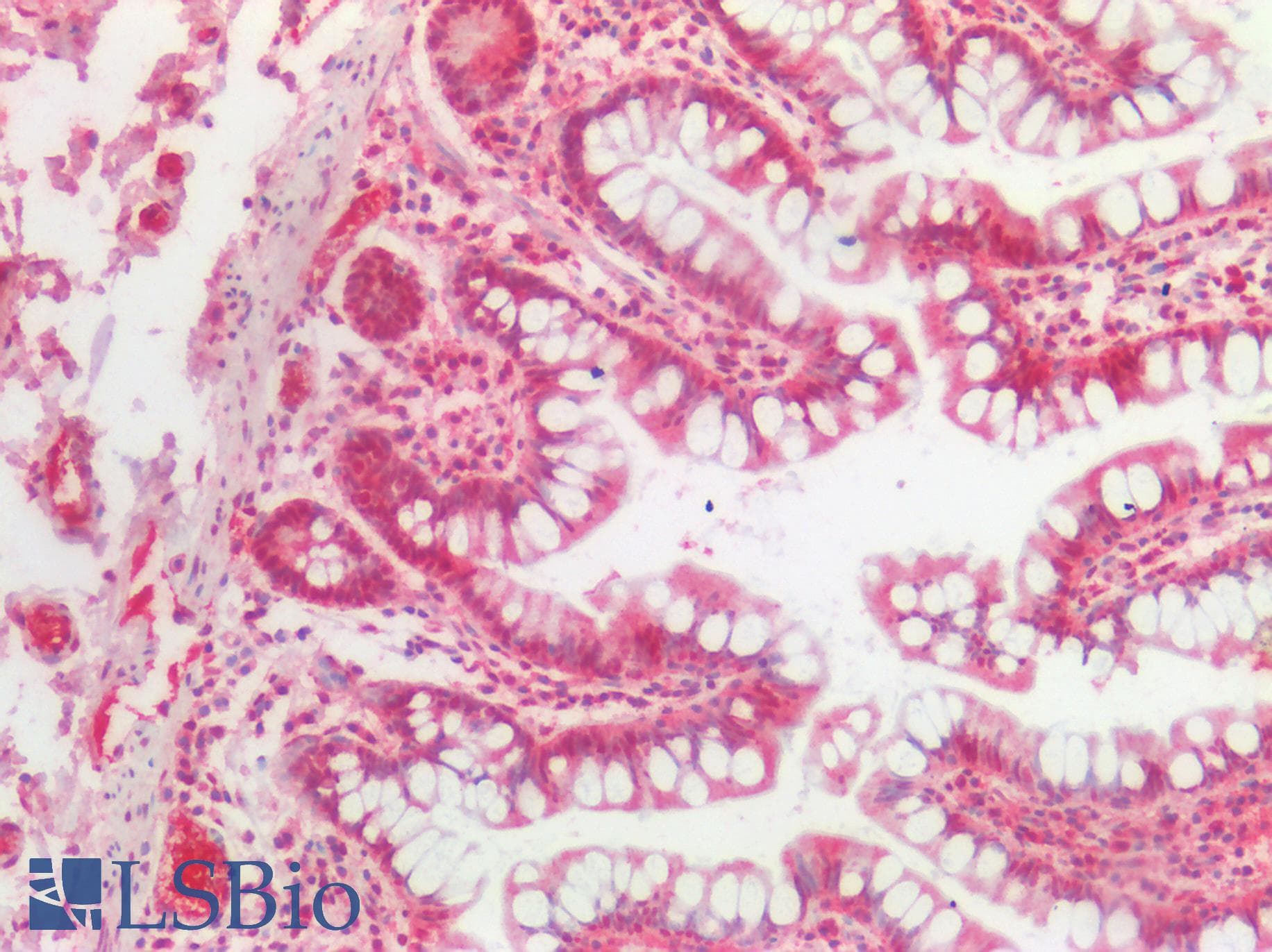 IHC-plus™ CSNK1A1 / CK1 Alpha Antibody (aa100-200)