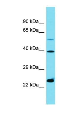 HNRNPC / HNRNP C Antibody (C-Terminus)
