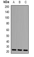 Polyclonal Rabbit anti-Human N6AMT1 Antibody (IF, WB)