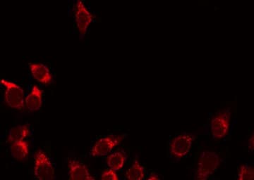 PLG / Plasmin / Plasminogen Antibody