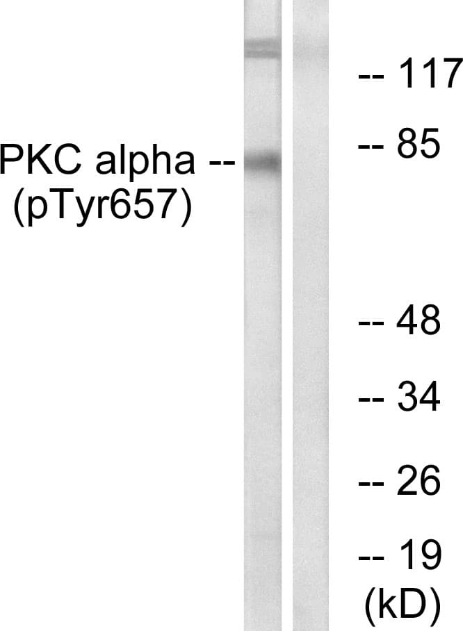 PRKCA / PKC-Alpha Antibody (phospho-Tyr657)