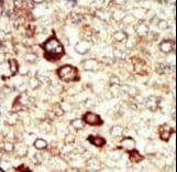 Polyclonal Rabbit anti-Human FGFR4 Antibody (aa24-55, IHC, IF, WB)