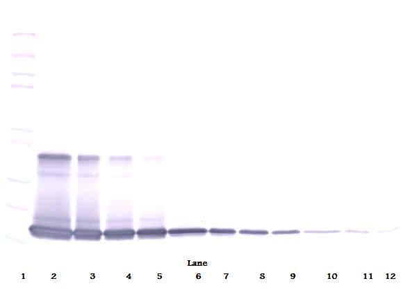 IL1A / IL-1 Alpha Antibody