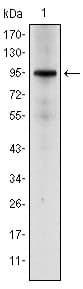 IHC-plus™ NR3C1/Glucocorticoid Receptor Antibody (clone 6E6)