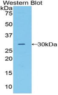 MST1R / RON Antibody (aa1092-1316)