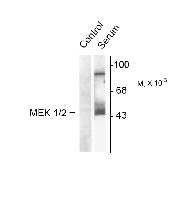 MAP2K1 / MKK1 / MEK1 Antibody (phospho-Ser218/Ser222)