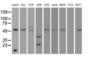 IHC-plus™ Monoclonal Mouse anti-Human SERPINA1 / Alpha 1 Antitrypsin Antibody (clone 9A1, IHC, WB)