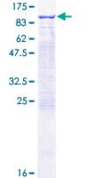 Human RHOT2 Protein (Recombinant GST)