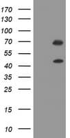 Monoclonal Mouse anti-Human TRMT2A Antibody (clone OTI3B7, WB)