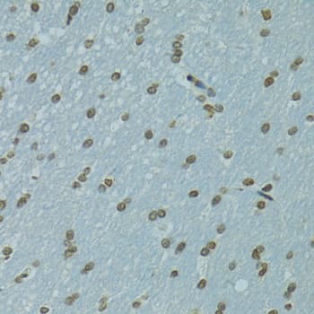 AHR Antibody