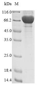 Human FAM20C Protein (Recombinant 10His, N-terminus + Myc, C-terminus)