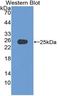 ADCY4 / Adenylate Cyclase 4 Antibody (aa352-541, PE)