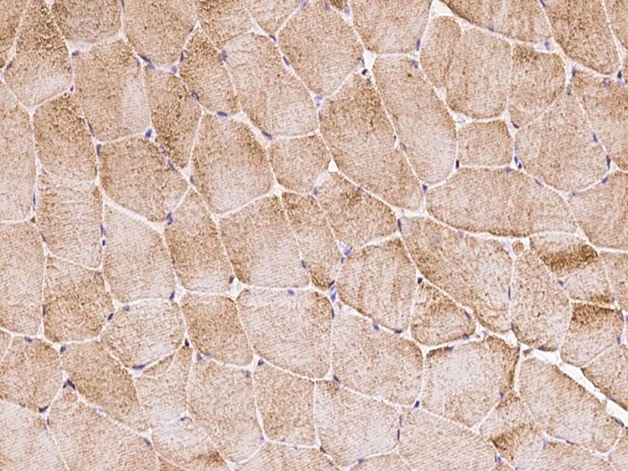 Obscurin / OBSCN Antibody