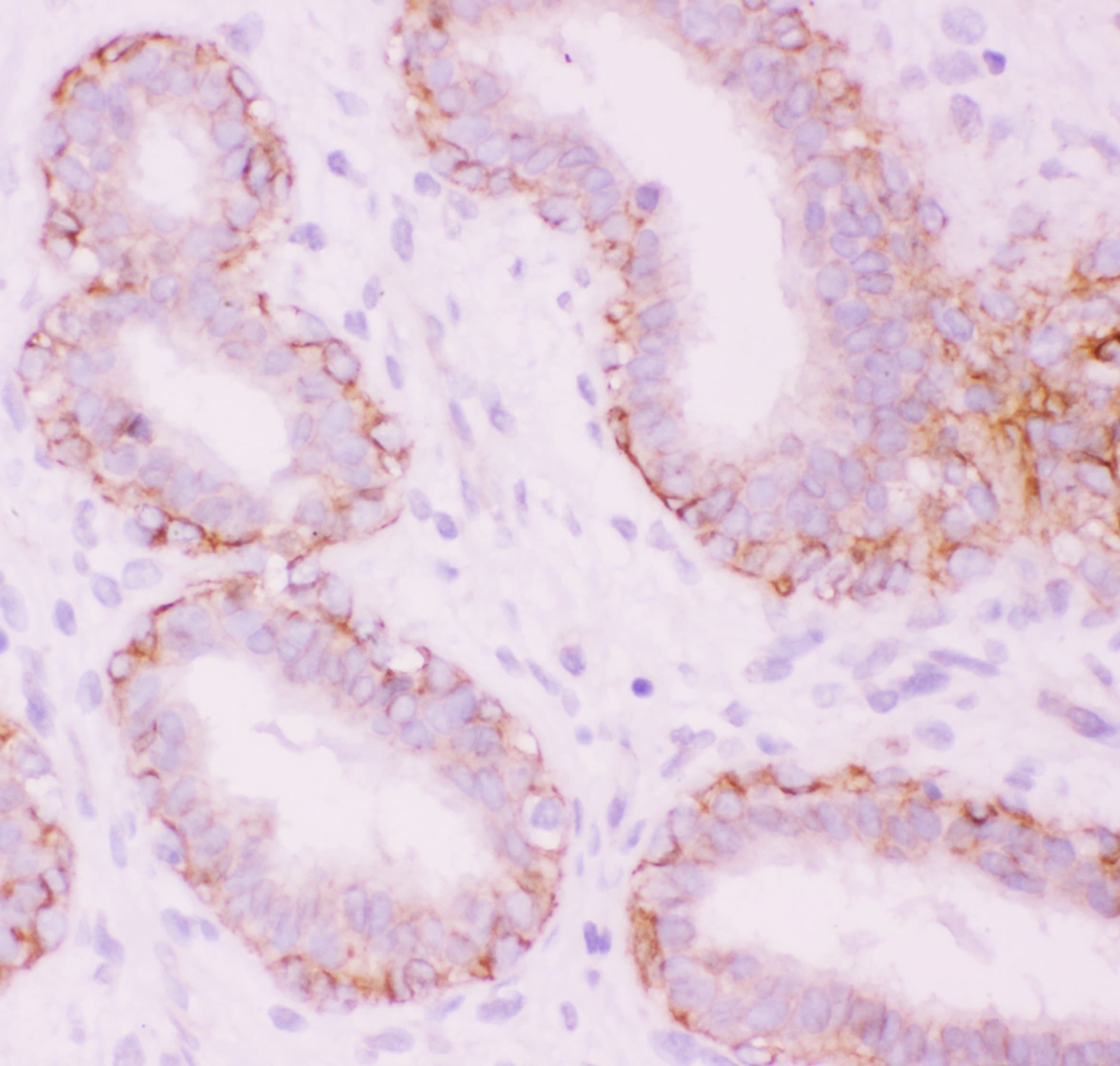 CTNNA1 / Catenin Alpha-1 Antibody (aa143-292)