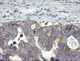 PIK3C2B Antibody (clone OTI2G3)