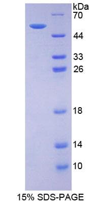 Mouse ESR2 / ER Beta Protein (Recombinant His)