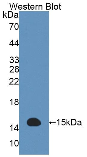ACYP2 Antibody (aa2-99, Cy3)