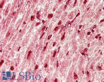 IHC-plus™ Polyclonal Rabbit anti-Human Arkadia / RNF111 Antibody (aa889-938, IHC, WB)