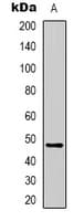 Alpha-1-Antichymotrypsin Antibody (Internal)