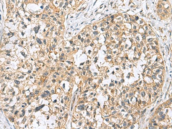 Polyclonal Rabbit anti-Human SKI Antibody (IHC, WB)