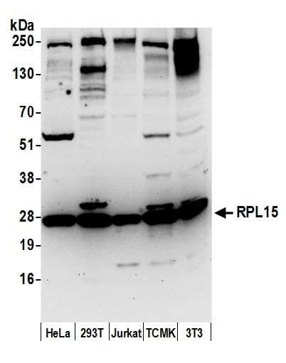 RPL15 / Ribosomal Protein L15 Antibody (aa50-100)