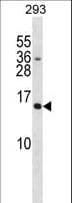SH2D1A / SAP Antibody (aa85-114)