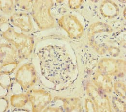 Polyclonal Rabbit anti-Human SUCLA2 Antibody (IHC, WB)