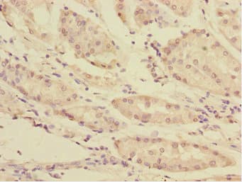 TOB2 Antibody