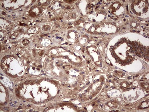 Monoclonal Mouse anti-Human BFSP2 Antibody (clone OTI4E7, aa184-415, IHC, WB)