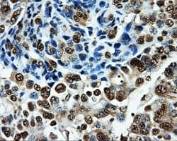 PKMYT1 Antibody (clone OTI5E1)