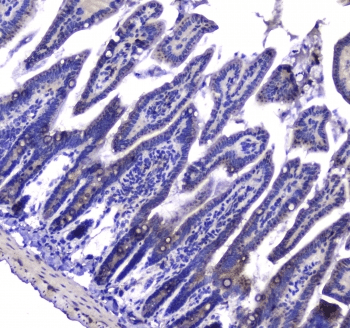 Polyclonal Rabbit anti-Human MAC-2-BP / LGALS3BP Antibody (IHC, WB)