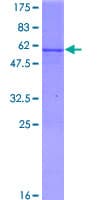 Human MMAB Protein (Recombinant GST)