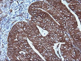 MAP2K1 / MKK1 / MEK1 Antibody (clone OTI1E5)