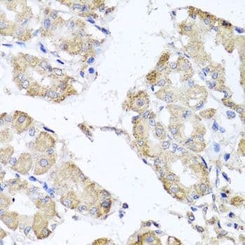 MICA Antibody
