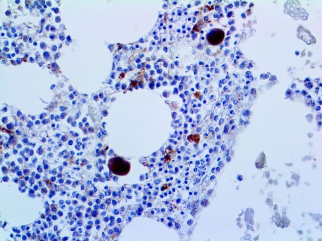 Recombinant Monoclonal Rabbit anti-Human IL2RA / CD25 Antibody (clone RBT-CD25, IHC)