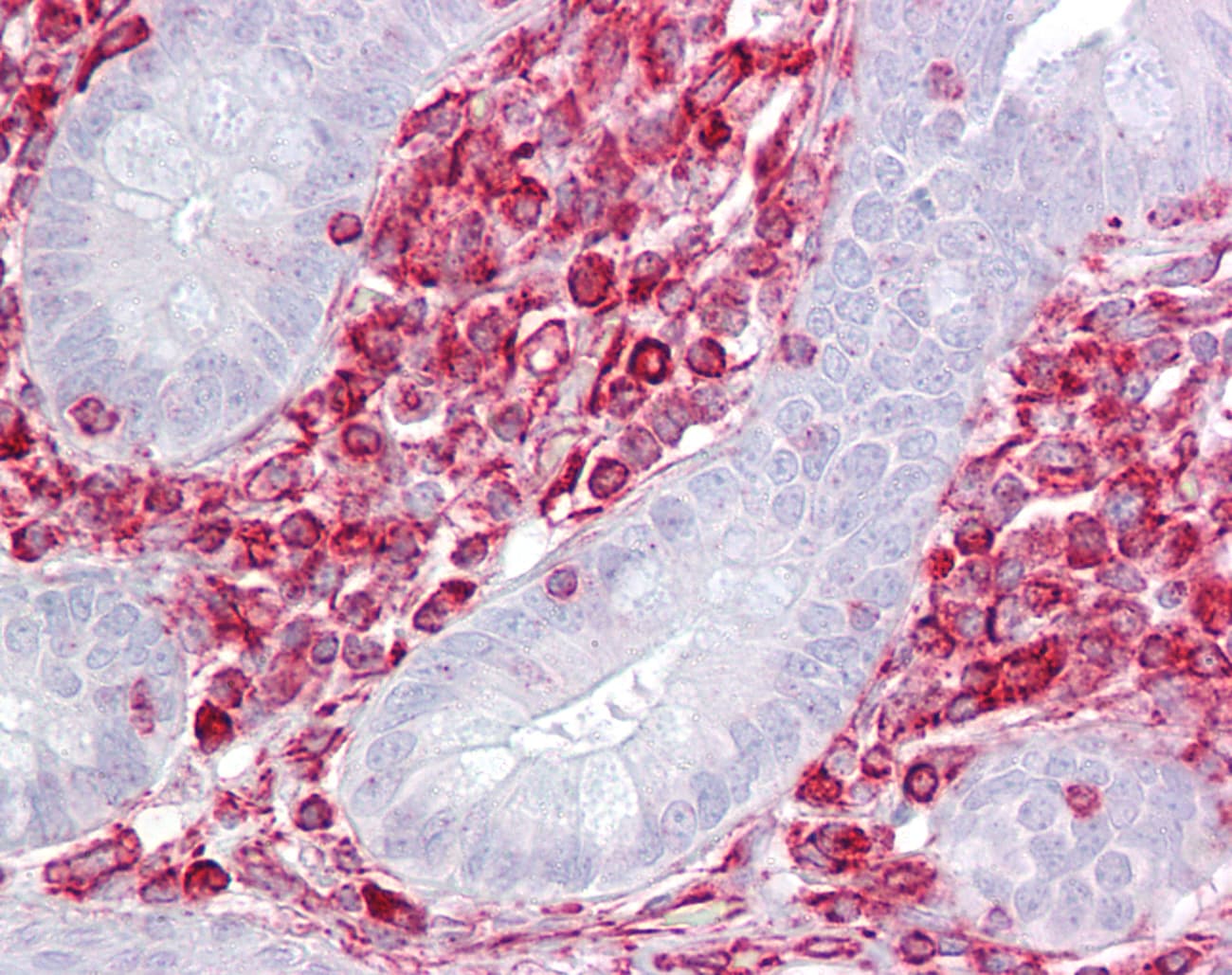 GNB2L1 / RACK1 Antibody (aa71-120)
