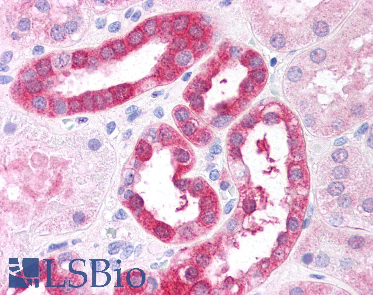 IHC-plus™ RICTOR Antibody (aa1722-1732)