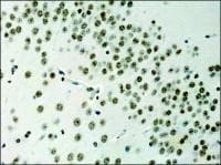 Histone H3 Antibody (aa100-150)