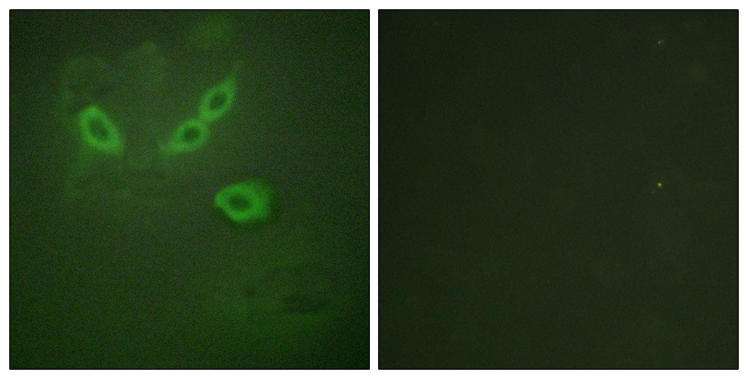TUSC5 Antibody