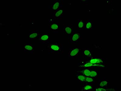 HIST1H4I Antibody