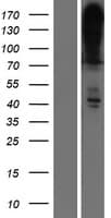 ATP2B4 / PMCA4 Protein (Over-Expression Lysate Myc-DDK (Flag))